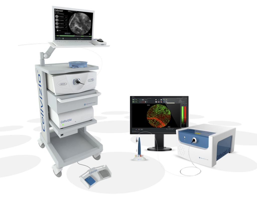 Imagen: El sistema de endomicroscopia láser confocal basado en la sonda Cellvizio (pCLE) (Fotografía cortesía de Mauna Kea Technologies).
