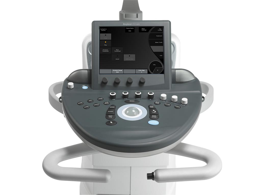 Imagen: El sistema de ultrasonido Aixplorer Ultimate, que cuenta con capacidades de ShearWave Elastography y UltraFast Doppler (Fotografía cortesía de SuperSonic Imagine). Imagen: El sistema de ultrasonido Aixplorer Ultimate, que cuenta con capacidades de ShearWave Elastography y UltraFast Doppler (Fotografía cortesía de SuperSonic Imagine).
