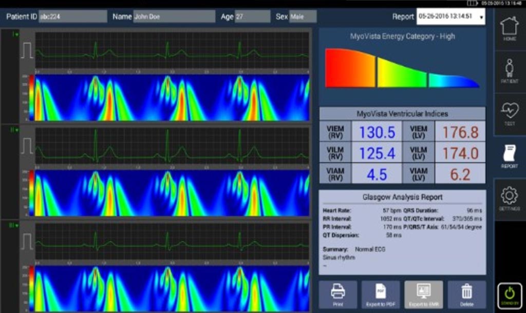 Imagen: El MyoVista proporciona una visualización detallada de la distribución de energía durante el ciclo cardíaco (Fotografía cortesía de HeartSciences).