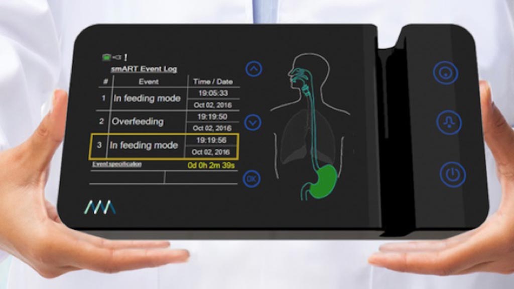 Imagen: Un sistema de alimentación basado en sensores puede prevenir complicaciones potencialmente mortales en la UCI (Fotografía cortesía de Art Medical).