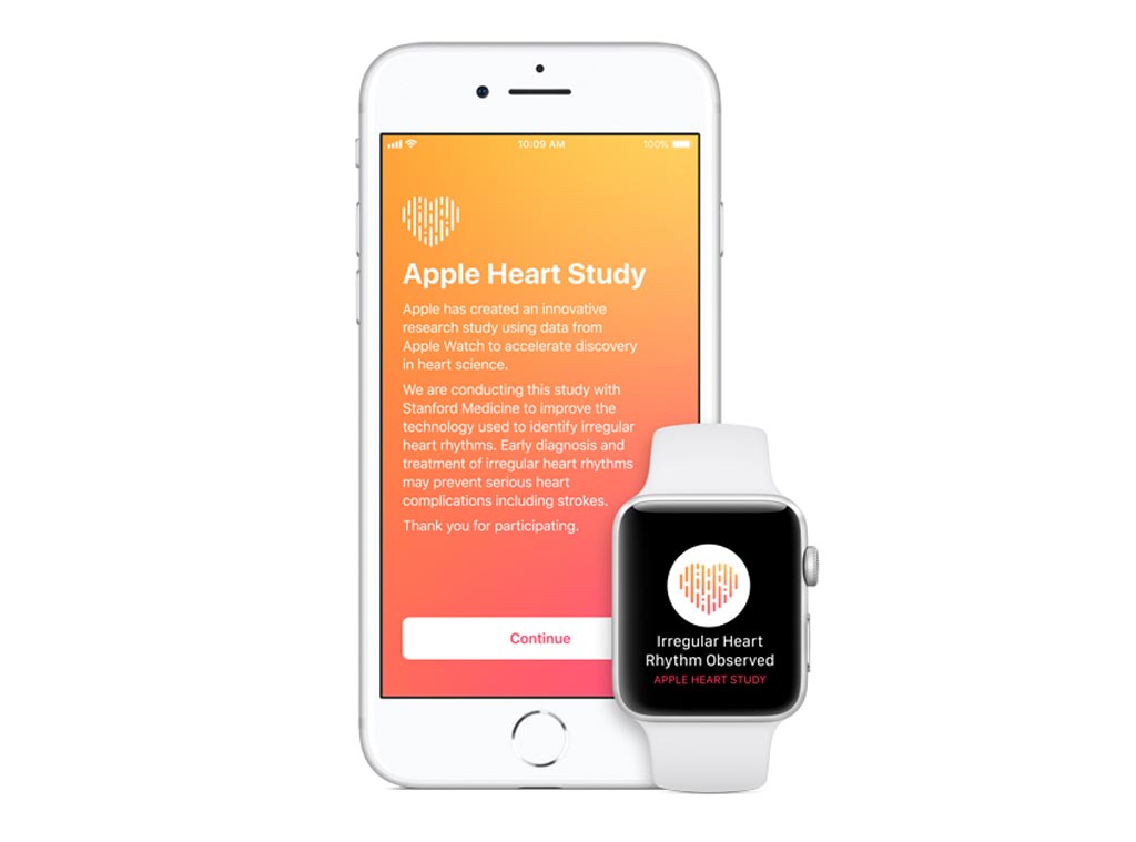Imagen: Apple y Stanford han lanzado conjuntamente un estudio para identificar la fibrilación auricular (Fotografía cortesía de Apple).