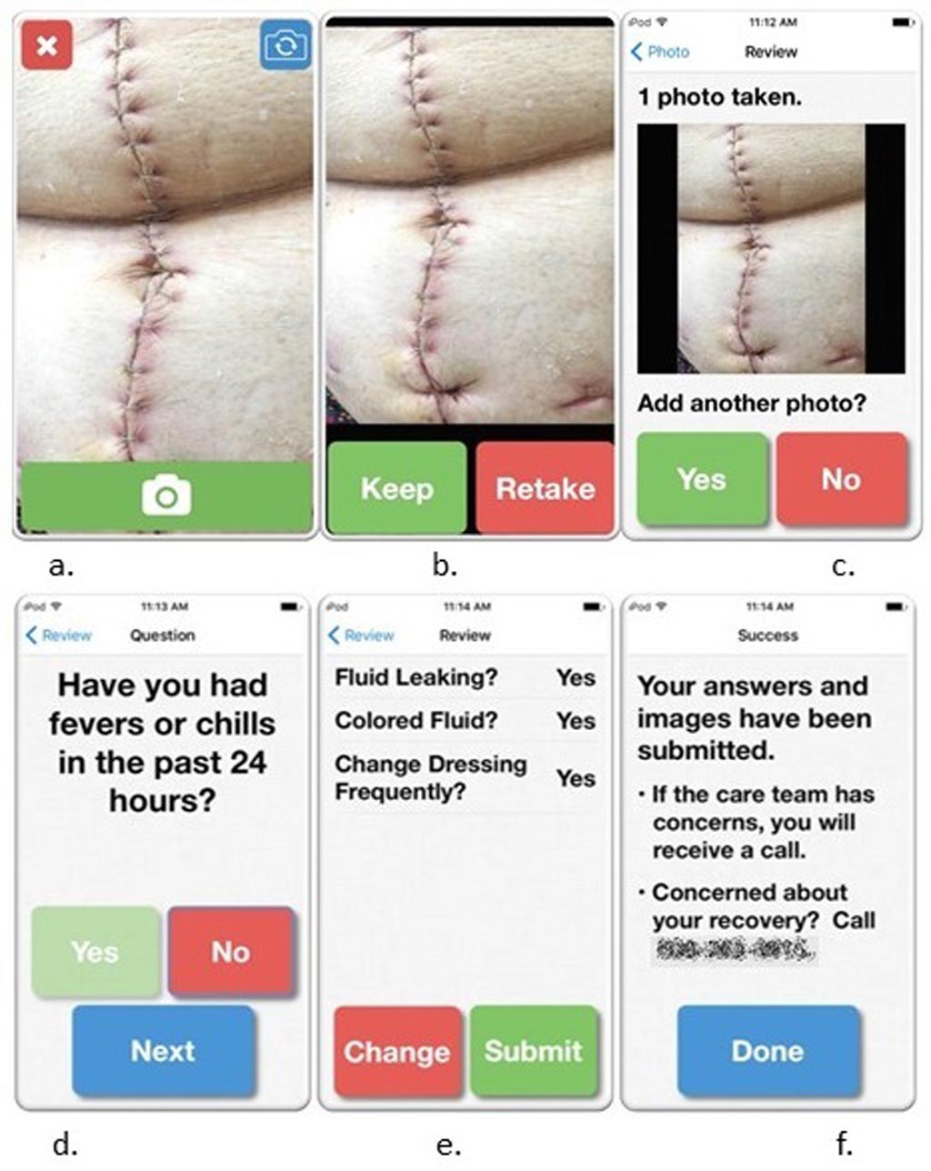 Imagen: Una aplicación ayuda a los pacientes y a los médicos a controlar la curación de las heridas (Fotografía cortesía de WISC).