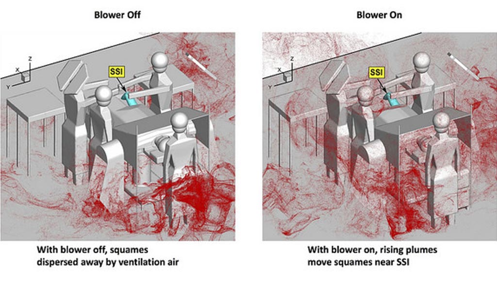 Imagen: La dispersión de escamas aéreas en una sala de operaciones (Fotografía cortesía de la OSU).