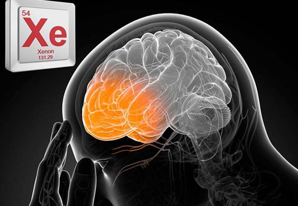 Imagen: Un nuevo estudio sugiere que el gas xenón puede proteger al cerebro de la lesión traumática por explosión (Fotografía cortesía de ICL).