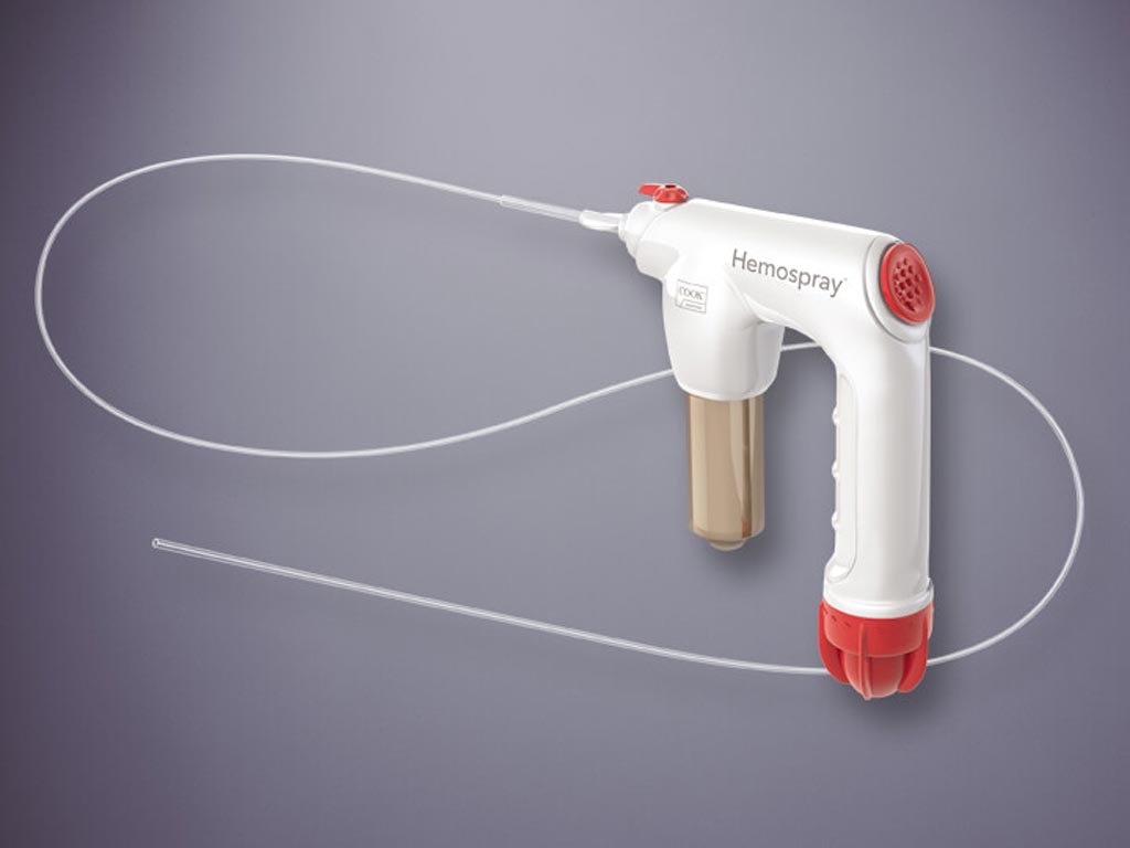 Imagen: El dispositivo de aerosol diseñado para ayudar a controlar las hemorragias gastrointestinales (Fotografía cortesía de Cook Medical).