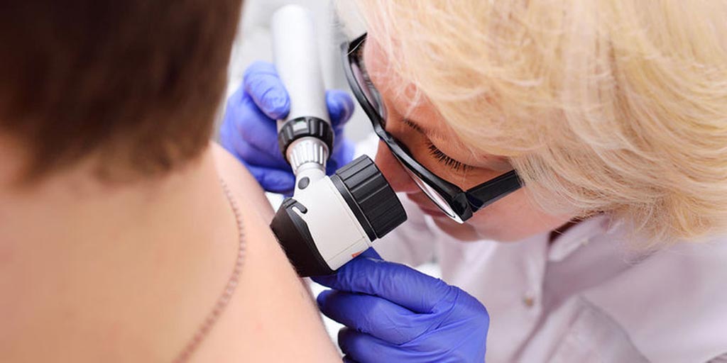 Imagen: Un nuevo estudio afirma que los algoritmos de aprendizaje profundo vencieron a los dermatólogos en la interpretación de las dermatoscopias (Fotografía cortesía de Dreamstime).
