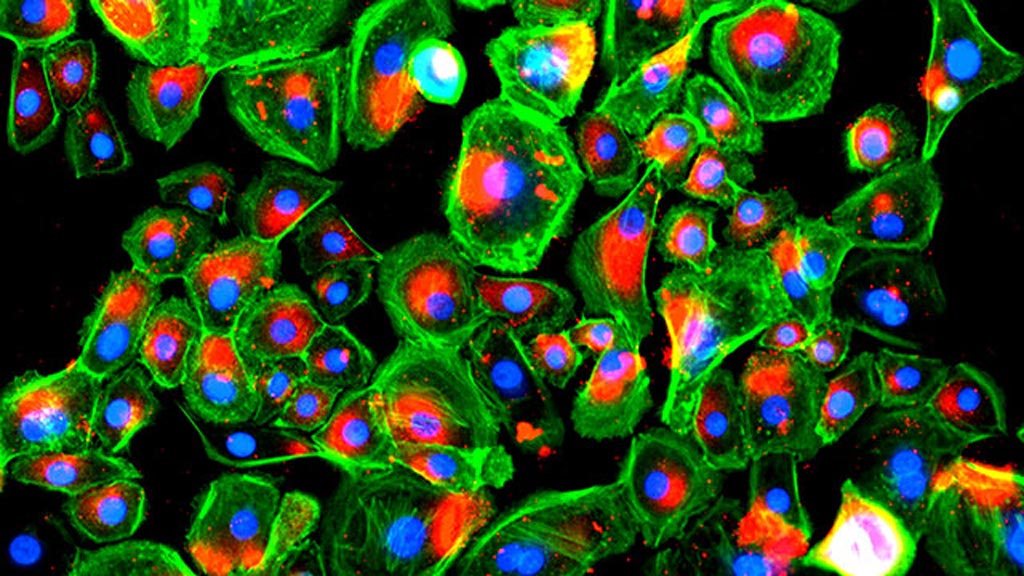 Imagen: Células de epidermis coloreadas cultivadas en el péptido A5G81 (Fotografía cortesía de Guillermo Ameer/Universidad Northwestern).