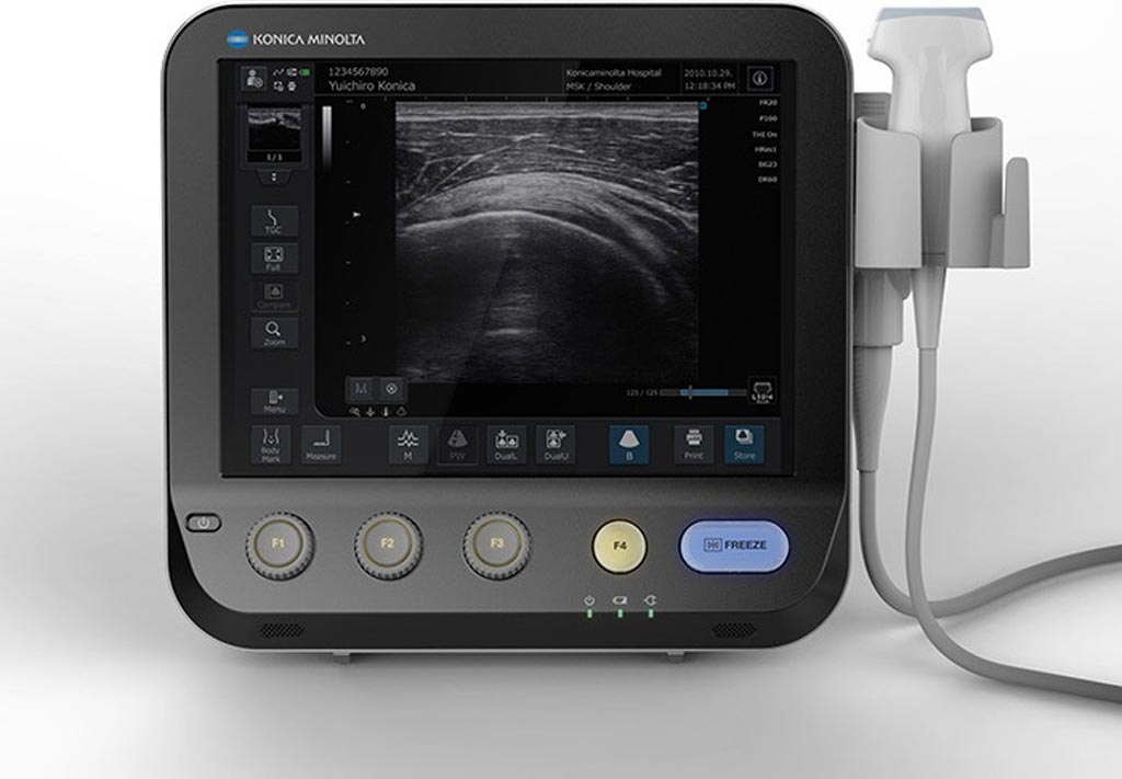 Imagen: El sistema de ultrasonido portátil SonImage MX1 (Fotografía cortesía de Konica Minolta). Imagen: El sistema de ultrasonido portátil SonImage MX1 (Fotografía cortesía de Konica Minolta).