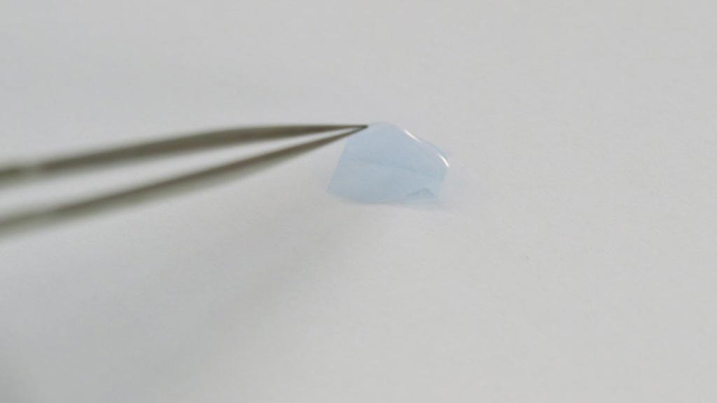 Imagen: un parche de alta tecnología utiliza nanoestructuras de metal para aumentar la intensidad de la fluorescencia 100 veces (Foto cortesía de WUSTL). Imagen: un parche de alta tecnología utiliza nanoestructuras de metal para aumentar la intensidad de la fluorescencia 100 veces (Foto cortesía de WUSTL).