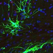 Imagen: las neuronas cervicales inactivas pueden comenzar a respirar después de una lesión en la médula espinal (Fotografía cortesía de Fehlings Lab, UT).