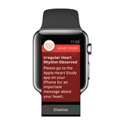 Imagen: El Apple Watch pronto podrá detectar la FA y otras arritmias (Fotografía cortesía de la Universidad de Stanford).