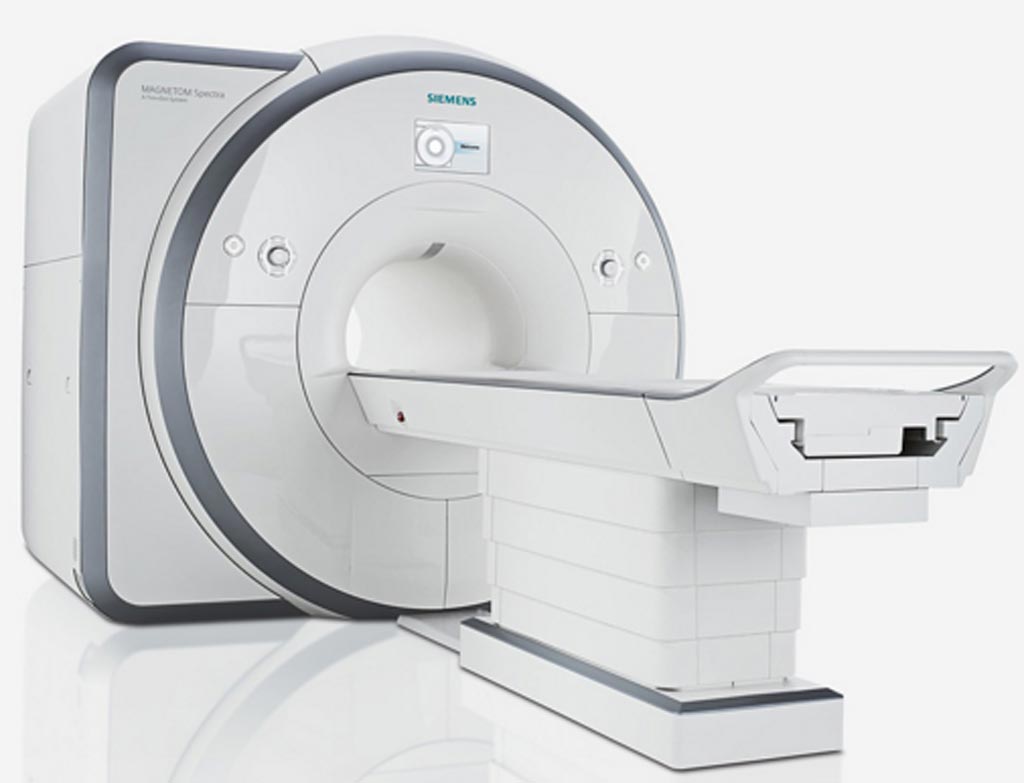 Imagen: Se proyecta que el crecimiento del tamaño del mercado global de sistemas de resonancia magnética será de casi 1.580 millones de dólares entre 2019-2023 (Fotografía cortesía de Siemens Healthcare).