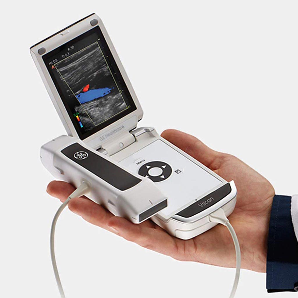 Imagen: El sistema de ultrasonido de mano Vscan (Fotografía cortesía de GE Healthcare).
