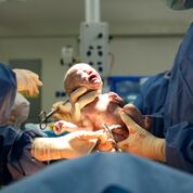 Imagen: Las estadísticas muestran que la cesárea es 100 veces más peligrosa en los países en desarrollo (Fotografía cortesía de Shutterstock). Imagen: Las estadísticas muestran que la cesárea es 100 veces más peligrosa en los países en desarrollo (Fotografía cortesía de Shutterstock).
