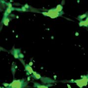 Imagen: El vidrio bioactivo por contener cobalto puede matar los patógenos bacterianos (Fotografía cortesía de la Universidad de Astom)