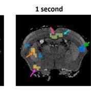 Imagen: La elastografía por resonancia magnética (ERM) puede mostrar la actividad cerebral en milisegundos (Fotografía cortesía de Science Advances). Imagen: La elastografía por resonancia magnética (ERM) puede mostrar la actividad cerebral en milisegundos (Fotografía cortesía de Science Advances).