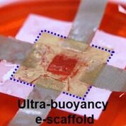 Imagen: Un andamio flotante en 3D que proporciona un seguimiento eficiente de la ingeniería de tejidos (Fotografía cortesía de ACS Nano). Imagen: Un andamio flotante en 3D que proporciona un seguimiento eficiente de la ingeniería de tejidos (Fotografía cortesía de ACS Nano).