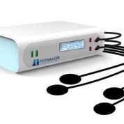 Imagen: Un dispositivo nuevo suprime las neuronas espinales hiperexcitables (Fotografía cortesía de PathMaker Neurosystems). Imagen: Un dispositivo nuevo suprime las neuronas espinales hiperexcitables (Fotografía cortesía de PathMaker Neurosystems).