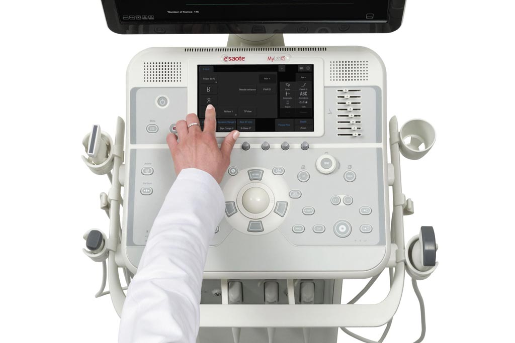 Imagen: El sistema de ultrasonido MyLab X5 (Fotografía cortesía de Esaote). Imagen: El sistema de ultrasonido MyLab X5 (Fotografía cortesía de Esaote).