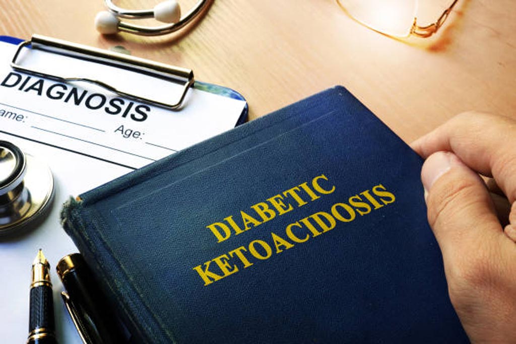 Imagen: Un estudio nuevo advierte que los medicamentos nuevos para la diabetes pueden causar que la cetoacidosis quirúrgica pase desapercibida (Fotografía cortesía de iStockPhoto). Imagen: Un estudio nuevo advierte que los medicamentos nuevos para la diabetes pueden causar que la cetoacidosis quirúrgica pase desapercibida (Fotografía cortesía de iStockPhoto).