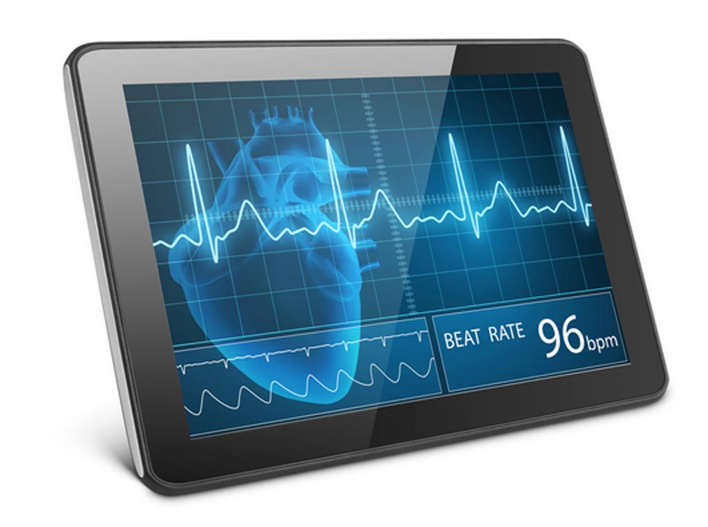 Imagen: Se espera que el mercado global de sistemas de ECG continúe creciendo durante el período de pronóstico 2019-2023, impulsado principalmente por los avances tecnológicos (Fotografía cortesía de Getty Images). Imagen: Se espera que el mercado global de sistemas de ECG continúe creciendo durante el período de pronóstico 2019-2023, impulsado principalmente por los avances tecnológicos (Fotografía cortesía de Getty Images).