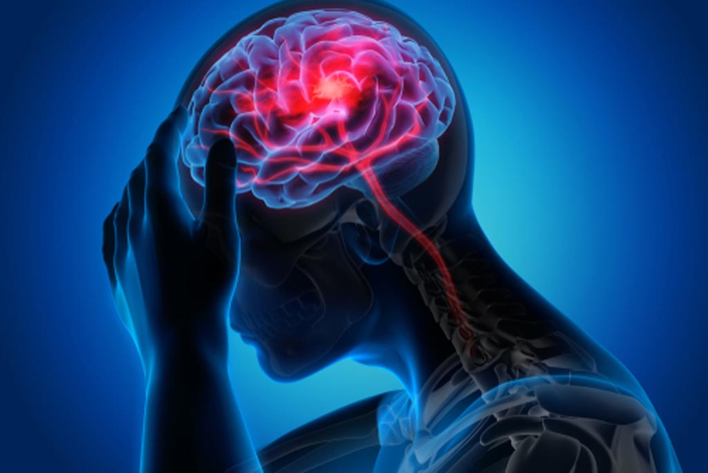 Imagen: Un estudio nuevo muestra que los accidentes cerebrovasculares silenciosos son comunes después de una cirugía no cardíaca (Fotografía cortesía de Shutterstock). Imagen: Un estudio nuevo muestra que los accidentes cerebrovasculares silenciosos son comunes después de una cirugía no cardíaca (Fotografía cortesía de Shutterstock).