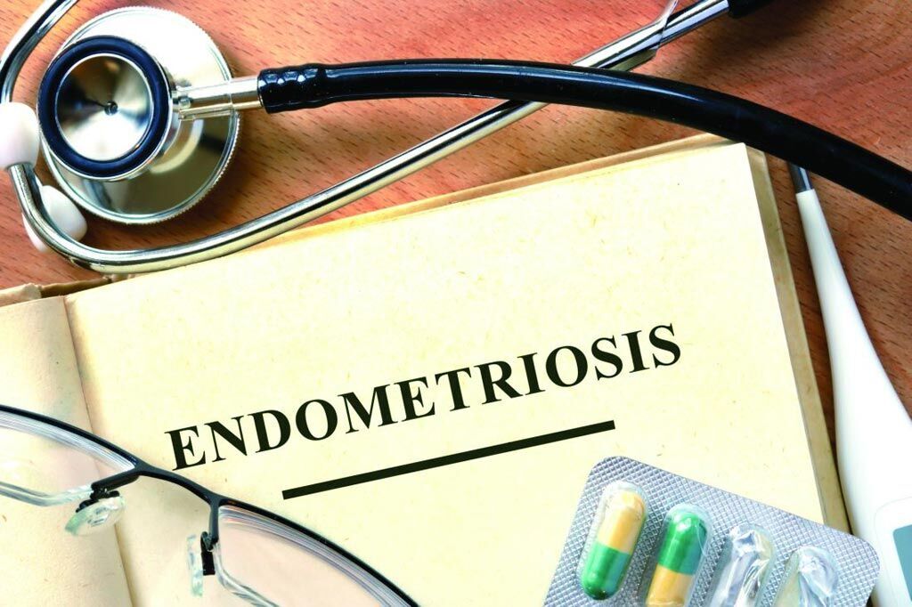 Imagen: Una investigación nueva asocia un aumento del riesgo de embarazos adversos con la endometriosis (Fotografía cortesía de iStock). Imagen: Una investigación nueva asocia un aumento del riesgo de embarazos adversos con la endometriosis (Fotografía cortesía de iStock).