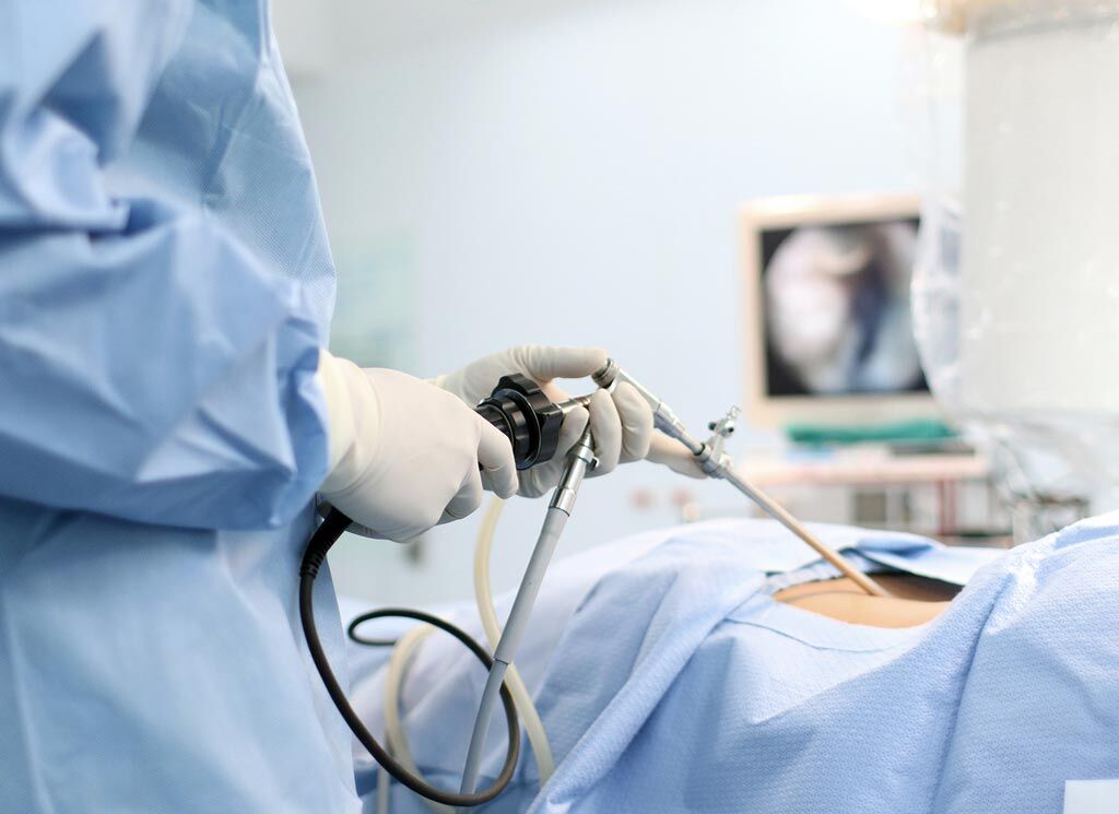Imagen: La lobectomía toracoscópica asistida por video produce mejores resultados, según un estudio nuevo (Fotografía cortesía de Shutterstock). Imagen: La lobectomía toracoscópica asistida por video produce mejores resultados, según un estudio nuevo (Fotografía cortesía de Shutterstock).