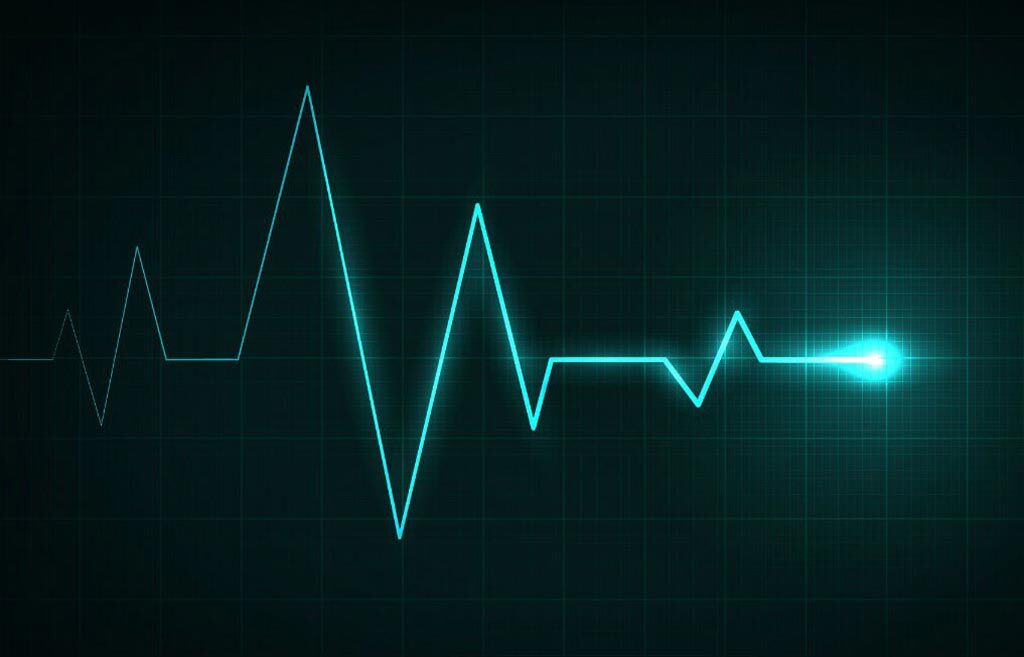 Imagen: Un estudio nuevo afirma que la insuficiencia cardíaca ahora se puede detectar con un solo latido cardíaco (Fotografía cortesía de la Universidad de Surrey).
