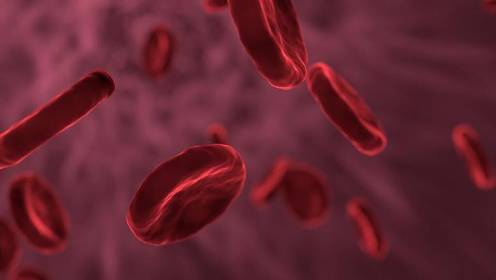 Imagen: Las estadísticas de un nuevo estudio muestran que las infecciones del torrente sanguíneo en las UCI en el Reino Unido disminuyeron drásticamente (Fotografía cortesía de 123rf.com).