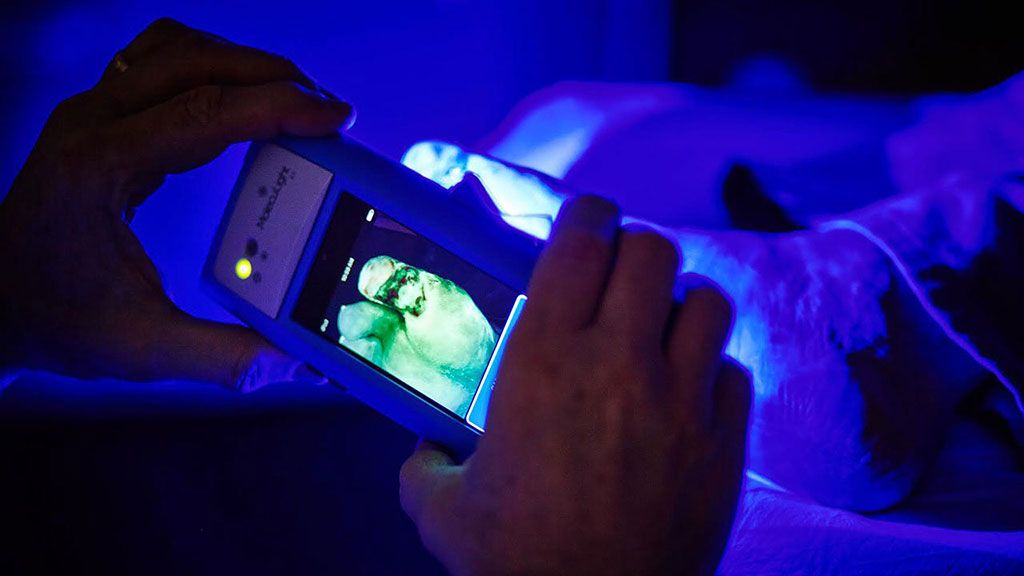 Imagen: El dispositivo portátil MolecuLight i:X utiliza imagenología de fluorescencia para identificar bacterias (Fotografía cortesía de MolecuLight)