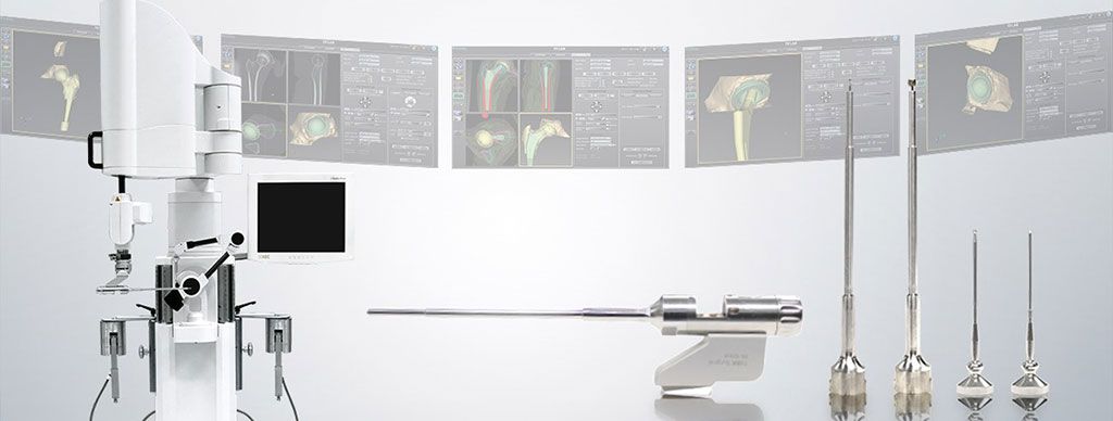Imagen: El Sistema Quirúrgico TSolution One mejora los procedimientos de reemplazo de articulaciones (Fotografía cortesía de THINK Surgical)