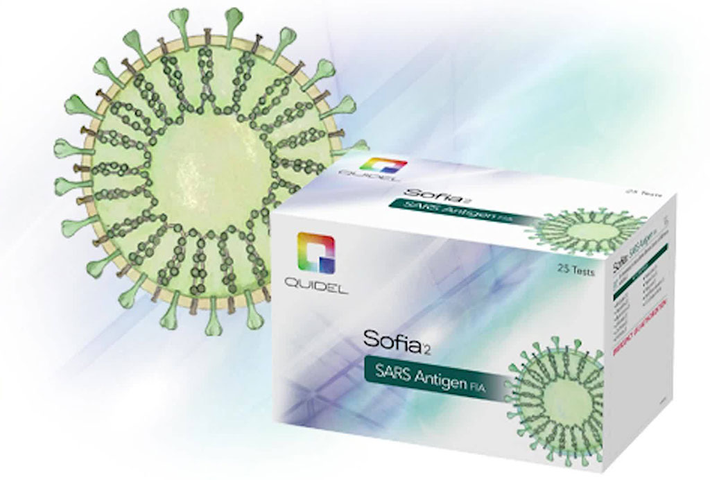 Imagen: La Sofia 2 SARS Antigen FIA de Quidel Corporation (Fotografía cortesía de Quidel Corporation) Imagen: La Sofia 2 SARS Antigen FIA de Quidel Corporation (Fotografía cortesía de Quidel Corporation)