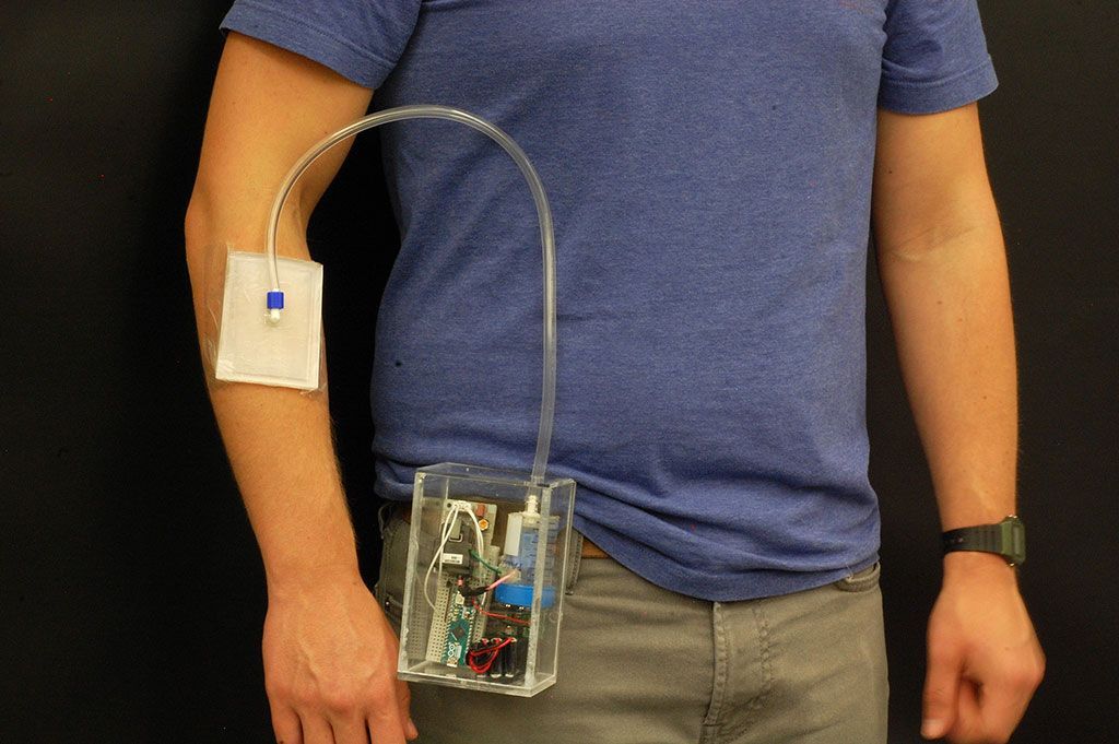 Imagen: Un generador pequeño de ozono ayuda a sanar las heridas (Fotografía cortesía de la Universidad de Purdue)