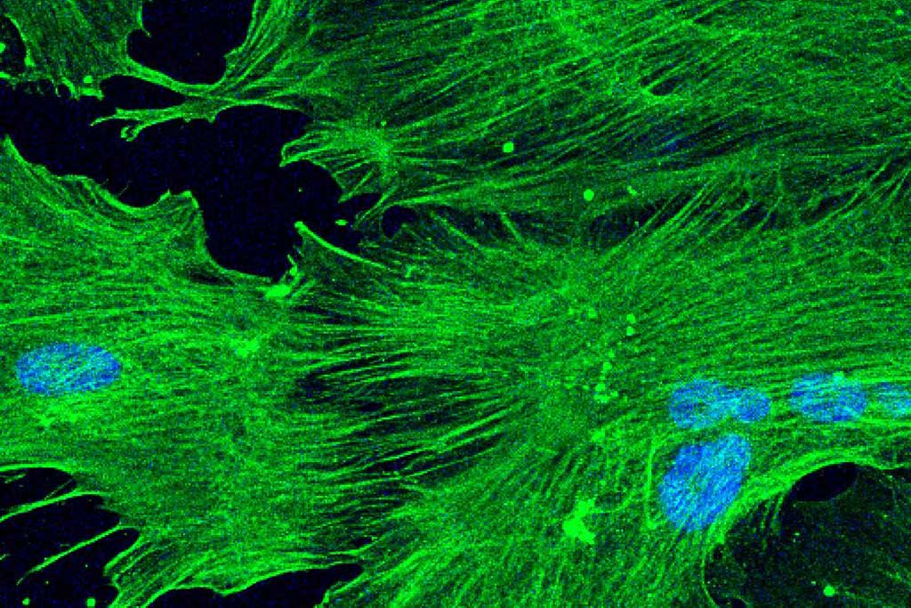 Imagen: Células del estroma mesenquimatoso (MSC) (Fotografía cortesía de la UCSF)