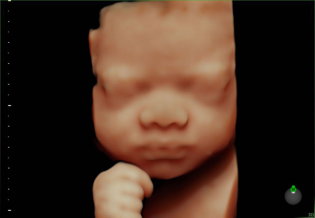 Imagen: Algoritmos nuevos de inteligencia artificial impulsan el escáner de ultrasonido Voluson SWIFT OB/GYN (Fotografía cortesía de GE Healthcare)