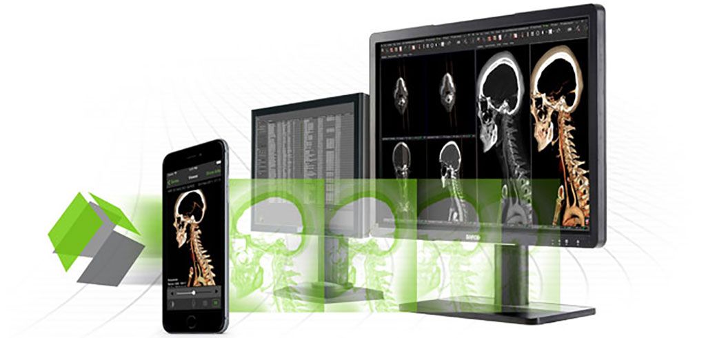 Imagen: La solución Visage 7 PACS (Fotografía cortesía de Visage Imaging)