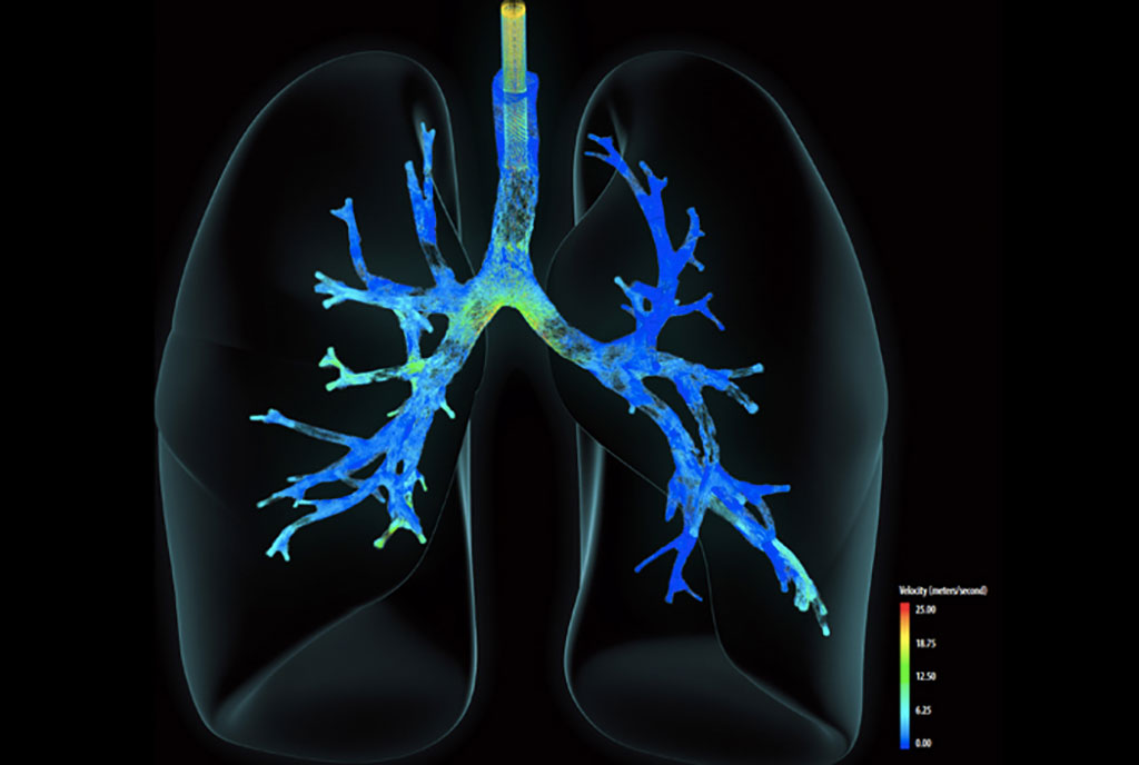 Imagen: La visualización matemática muestra la velocidad del aire que ingresa a los pulmones desde un ventilador pulsante de alta frecuencia (Fotografía cortesía del Laboratorio Nacional de Los Álamos)