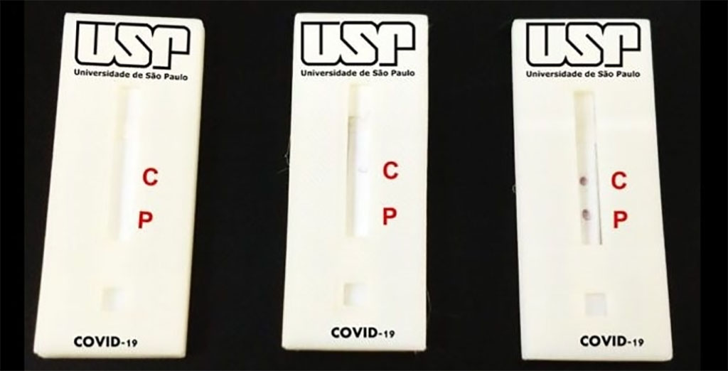 Imagen: La prueba de diagnóstico para la COVID-19 de 10 minutos basada en nanopartículas identifica los anticuerpos IgG y cuesta solo la quinta parte del precio promedio del mercado (Fotografía cortesía de Karla Castro/USP)