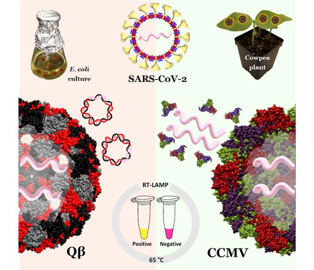 Imagen: Las nanopartículas similares al coronavirus, hechas de virus de plantas y bacteriófagos, podrían servir como controles positivos para la prueba RT-LAMP (Fotografía cortesía de Soo Khim Chan)