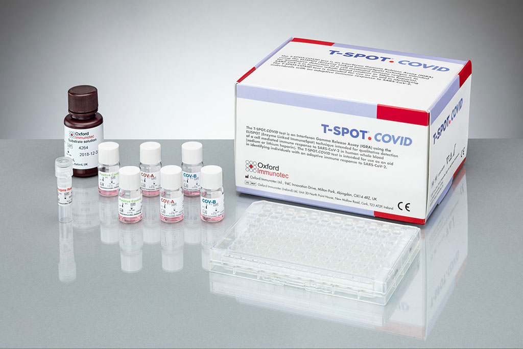 Imagen: Prueba T-SPOT.COVID (Fotografía cortesía de Oxford Immunotec Global PLC)