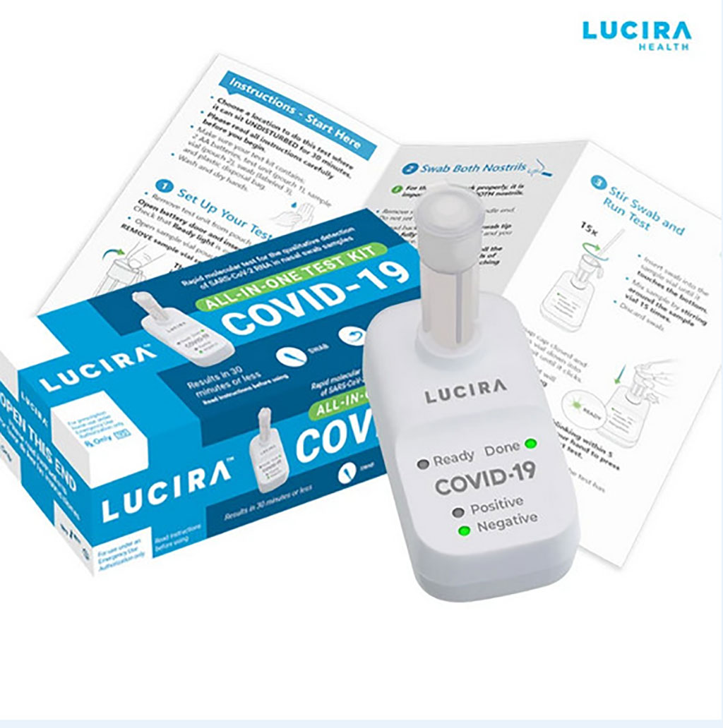 Imagen: Kit de análisis Todo-En-Uno LUCIRA COVID-19 (Fotografía cortesía de Lucira Health, Inc.)