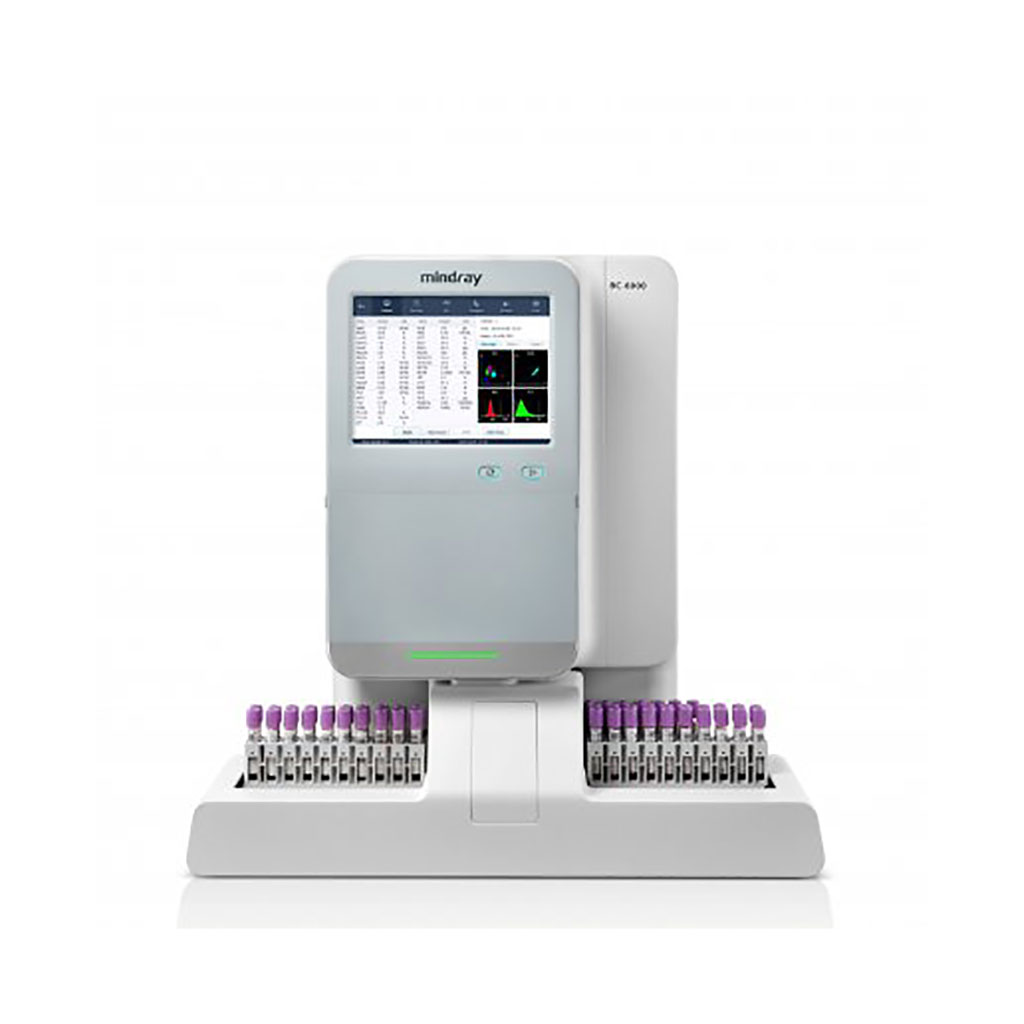 Imagen: Analizador automático de hematología Mindray BC- 6800 (Fotografía cortesía de Mindray)