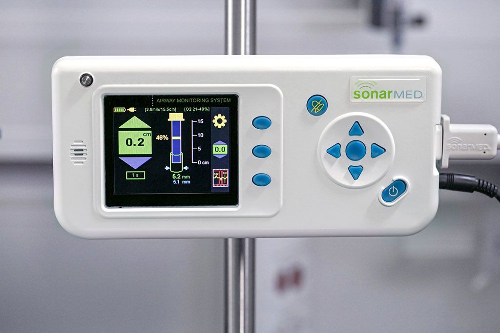 Imagen: El sistema de monitorización de las vías respiratorias SonarMed (Fotografía cortesía de Medtronic)