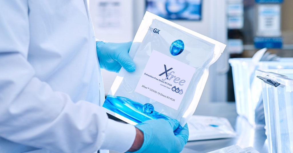 Imagen: La nueva prueba de RT-PCR COVID-19 de muestra directa de alto rendimiento de BioGX recibe la AUE de la FDA (Fotografía cortesía de BioGX)