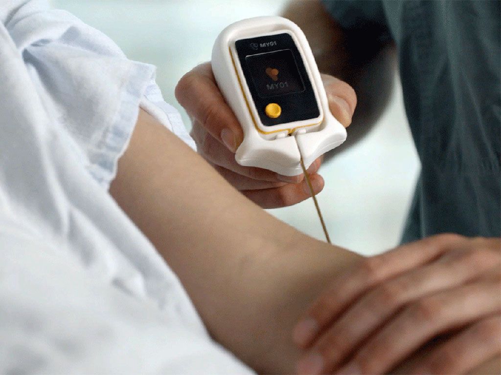 Imagen: Un monitor de presión compartimental novedoso proporciona mediciones de presión continuas y confiables en tiempo real para ayudar en el diagnóstico del síndrome compartimental (SC).