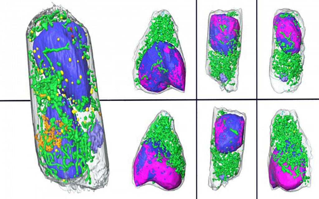 Imagen: Imágenes digitales de células infectadas con SARS-CoV-2 creadas a partir de tomografía de rayos X blanda (Fotografía cortesía de Berkeley Lab)
