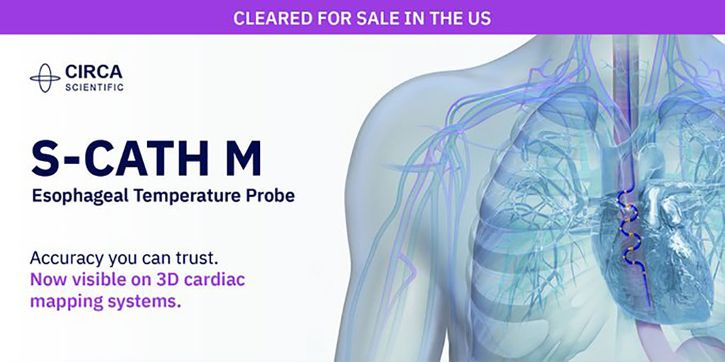 Imagen: La S-CATH M ha sido autorizada para la venta en EUA (Fotografía cortesía de CIRCA Scientific, Inc.)