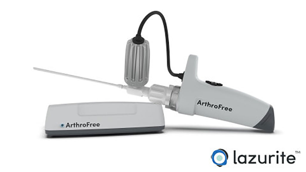 Imagen: ArthroFree System es el primer y único sistema de cámara inalámbrica aprobado por la FDA para cirugía mínimamente invasiva (Fotografía cortesía de Lazurite)