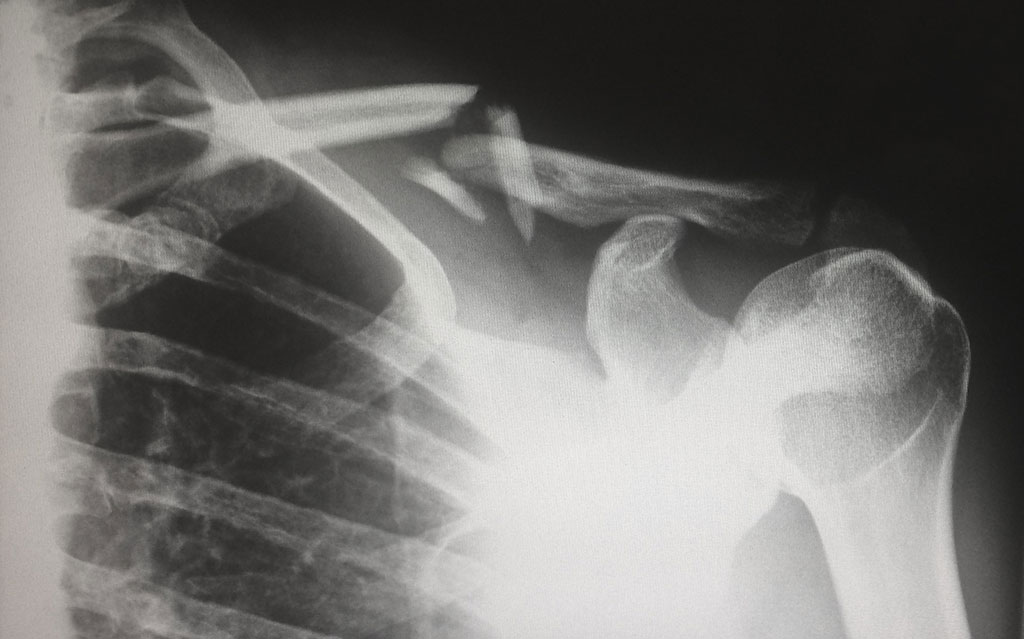 Imagen: El estudio apunta al uso de la IA como un "segundo lector" en la detección de fracturas (Fotografía cortesía de Unsplash)